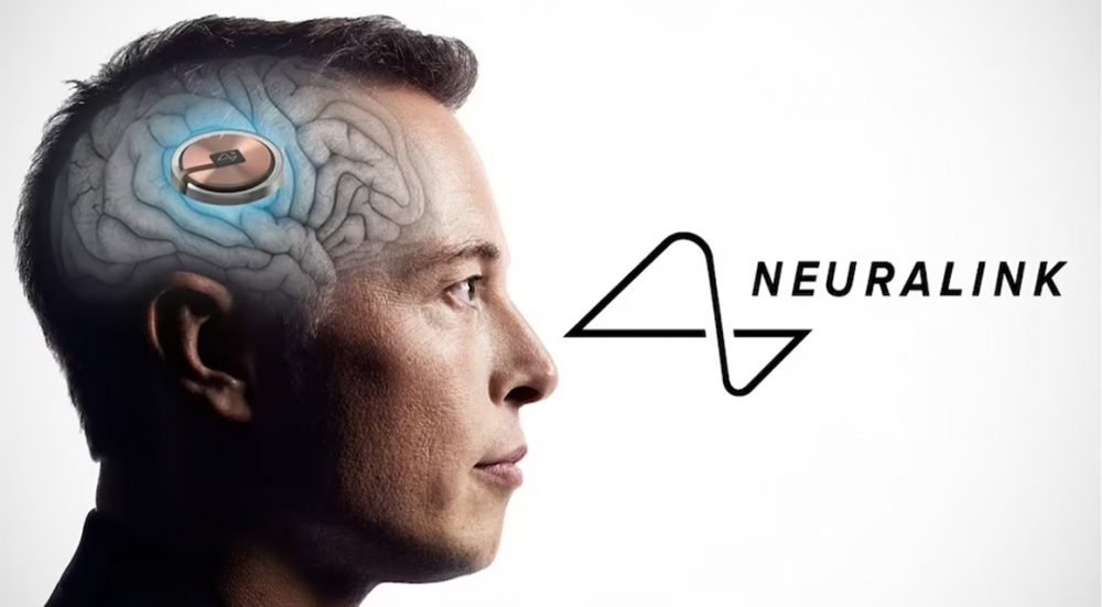 Neuralink insan beyninə çip yerləşdirmək üçün ABŞ-dən icazəni alıb